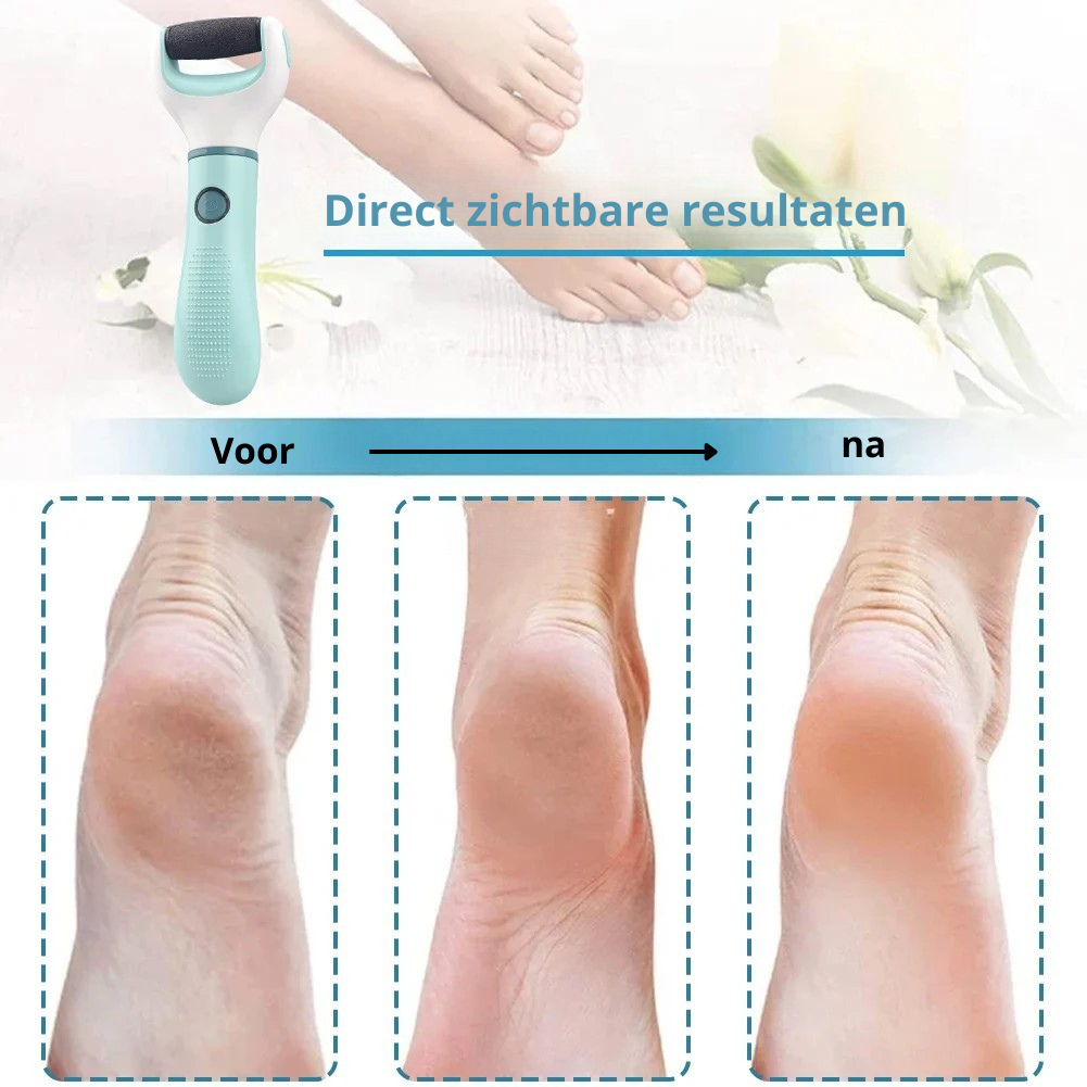SoftFeet™ 60% Korting