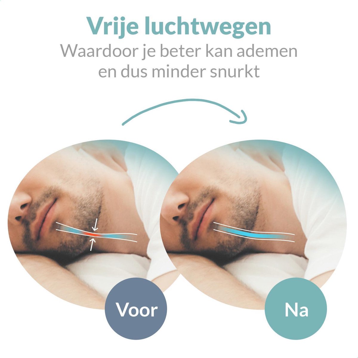 SilentSleep™ – Anti-Snurk Beugel