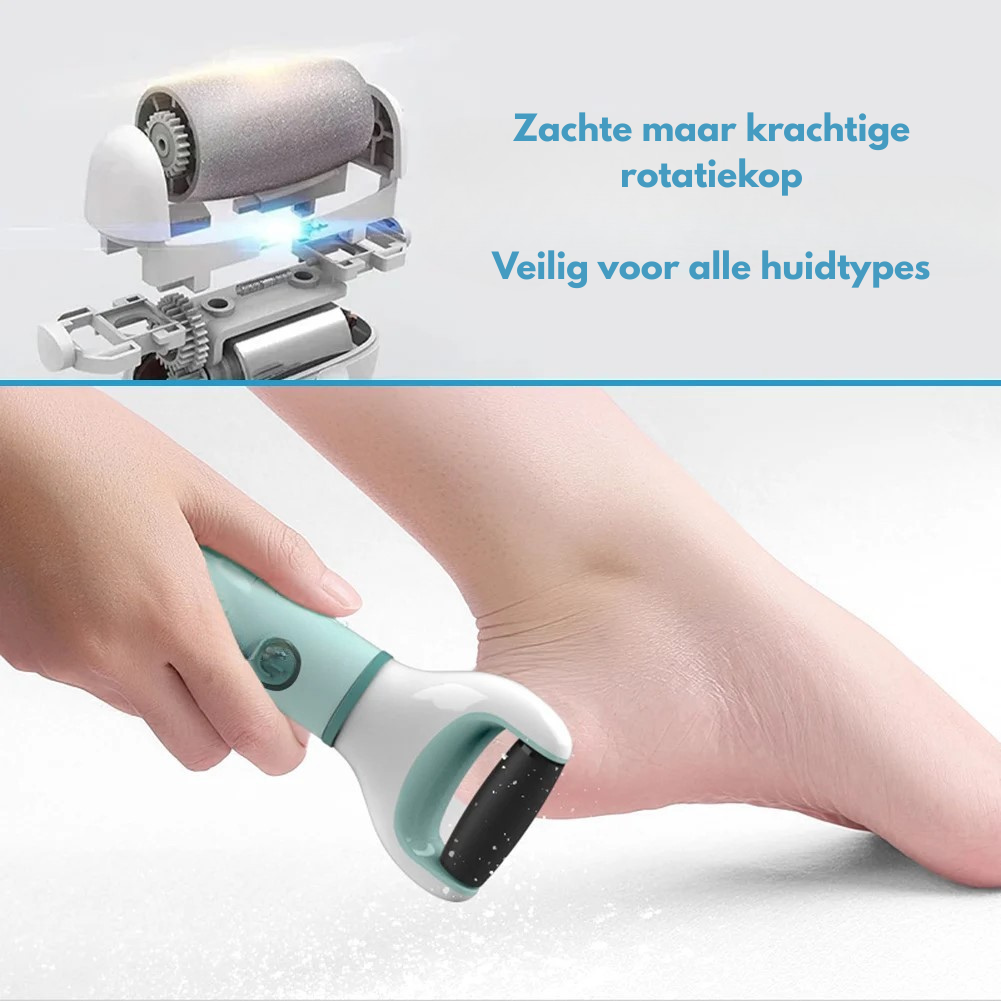 SoftFeet™ 60% Korting
