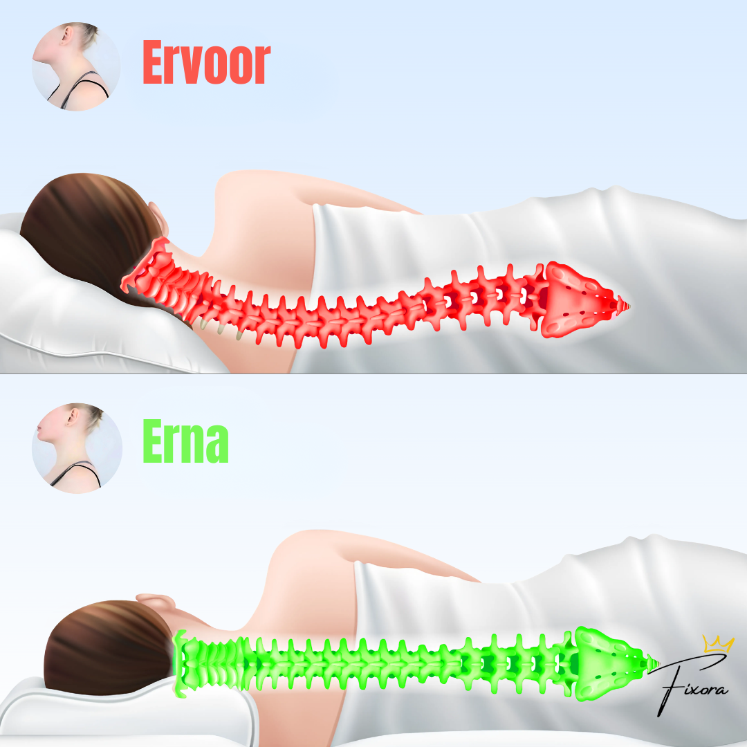 SlaapAlign™ - Orthopedisch - ergonomisch kussen