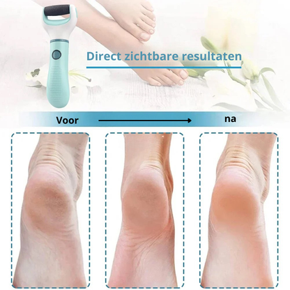 SoftFeet™ 60% Korting