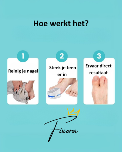 DermaNail™ | Intensieve Nagelverzorging bij Schimmel