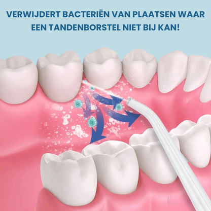 OraclynePro™ - Waterflosser