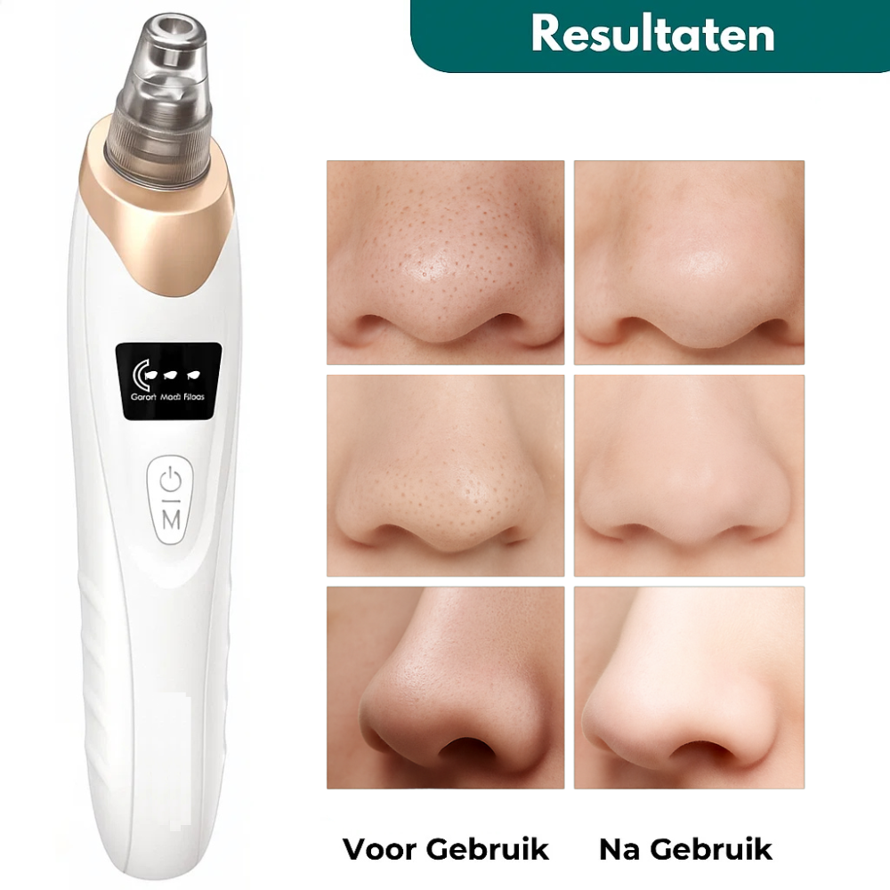 ClarifyOne™ – “Één tool. Schoner, gladder, fijner.”