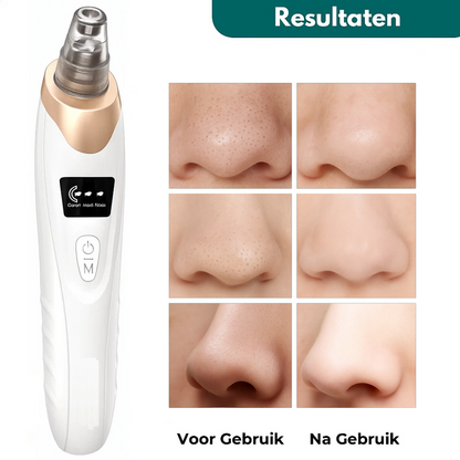 ClarifyOne™ – “Één tool. Schoner, gladder, fijner.”