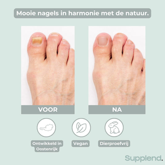 Supplend Nagelverzorgingspen