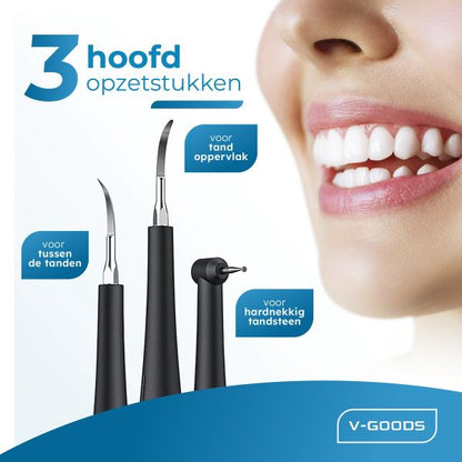 SonicBright™ – Vgood – Sonische kracht voor een wittere glimlach