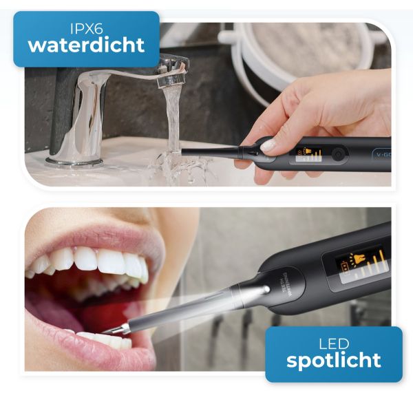 SonicBright™ – Vgood – Sonische kracht voor een wittere glimlach